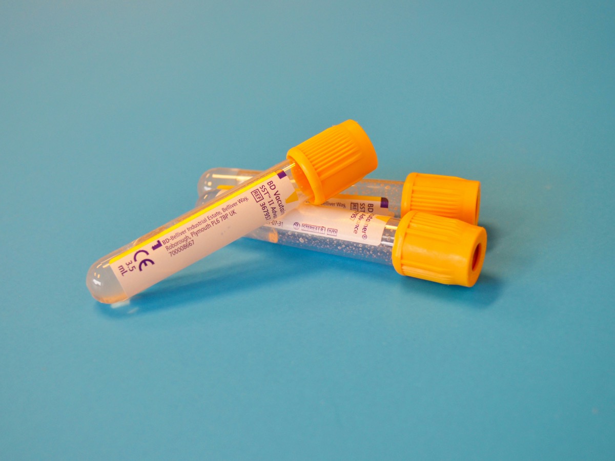 Labor und Funktionsdiagnostik – Blutröhrchen